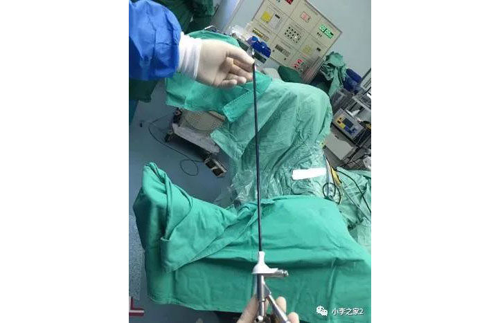 德國(guó):軟鏡腎結(jié)石手術(shù)的預(yù)置支架效果要優(yōu)于輸尿管結(jié)石預(yù)置支架